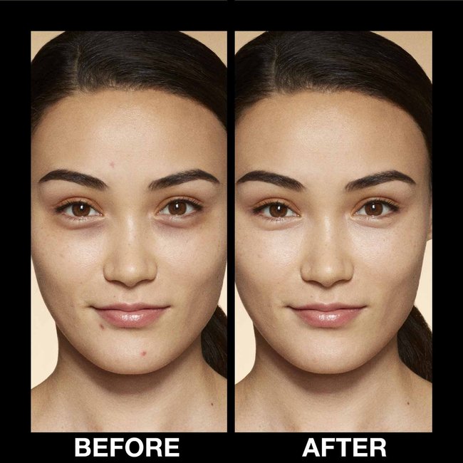 model showcasing how to cover up spots with makeup using concealer